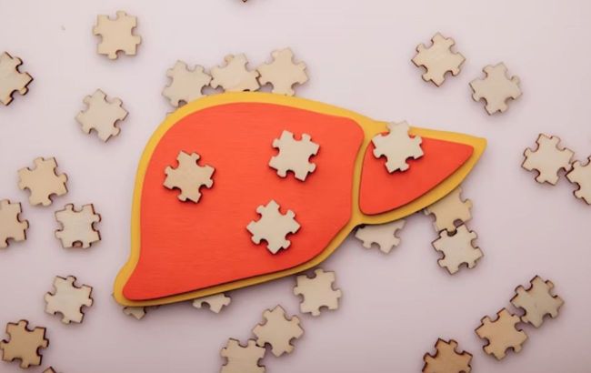 5 steps for healthy liver - Doctor's advice